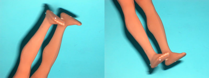 Illustration for article titled DIY Prosthetics: The Extreme Athlete Who Built a New Knee